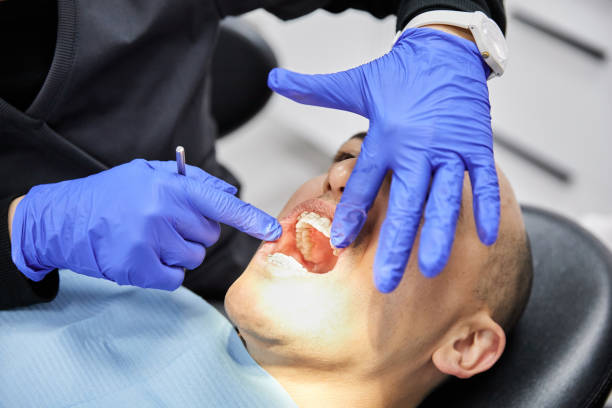 Best Broken or Cracked Tooth Emergency Dentist in Cathcart, WA